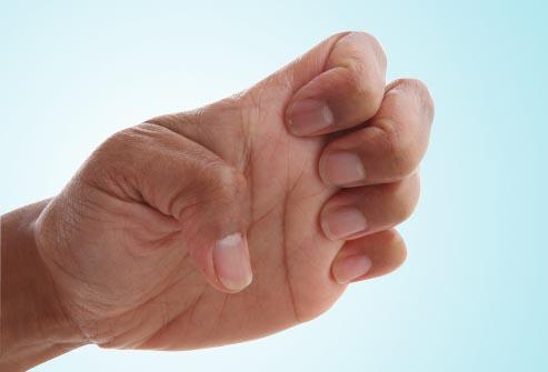 Các bài tập giảm đau hiệu quả cho người viêm khớp dạng thấp
