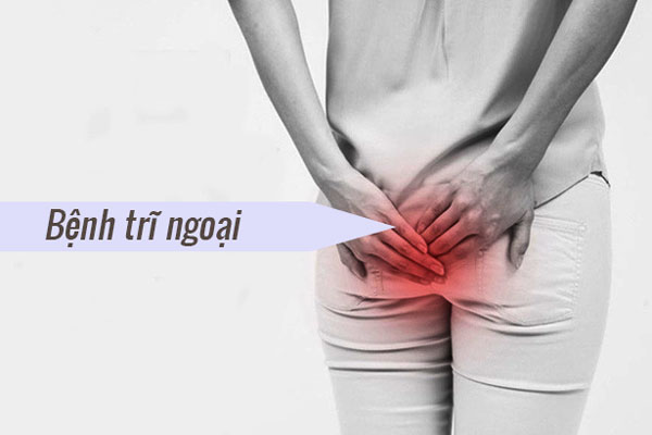 7 cách làm co búi trĩ ngoại hiệu quả bạn nên biết