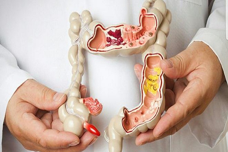 Trĩ ngoại độ 2 có nguy hiểm không? Tìm hiểu ngay để biết