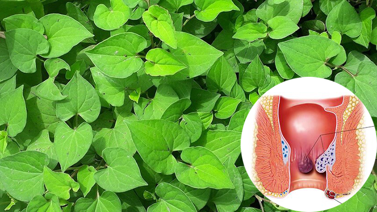 Trĩ ngoại độ 2 có nguy hiểm không? Tìm hiểu ngay để biết