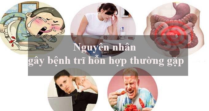 Trĩ hỗn hợp có nguy hiểm không? Nguyên nhân nào gây ra trĩ hỗn hợp?