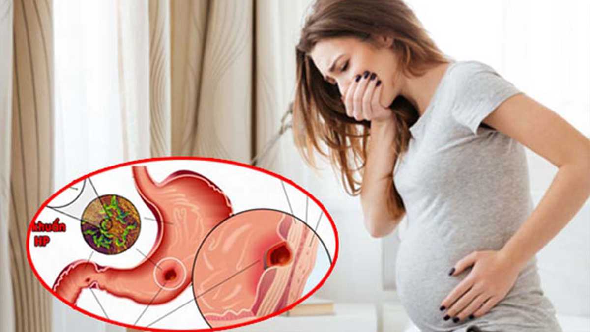 Phụ nữ khi mang thai bị đau dạ dày thì phải làm sao?