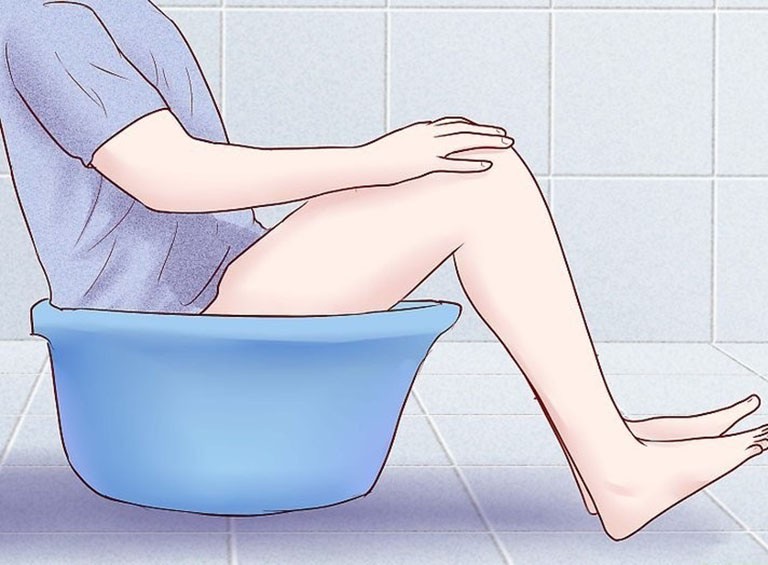 7 cách đơn giản giúp làm giảm sưng đau trĩ tức thời