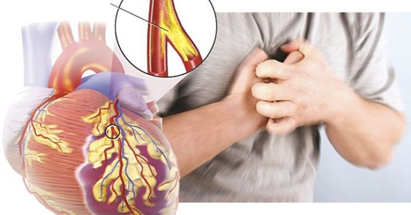 Bệnh suy tim độ 1 có nguy hiểm không? Tìm hiểu ngay để biết