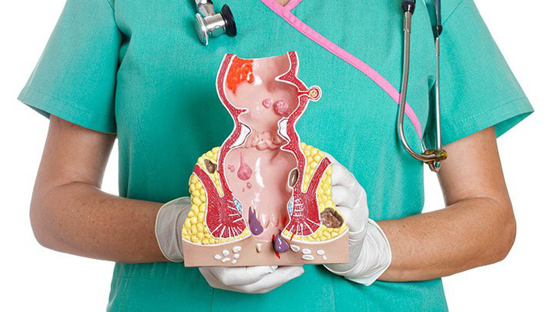 Dấu hiệu nhận biết trĩ huyết khối và cách điều trị hiệu quả
