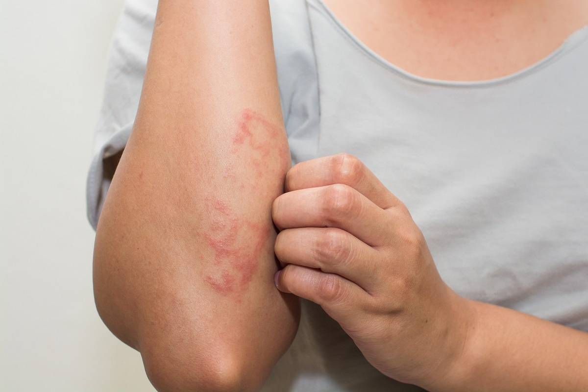 Top 9 vị trí ung thư da mà bạn không ngờ đến