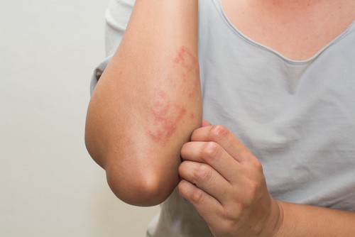 Dấu hiệu cảnh báo bệnh ung thư tai, có thể bạn chưa biết. 