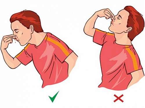 Cách xử lý khi chảy máu cam đúng cách