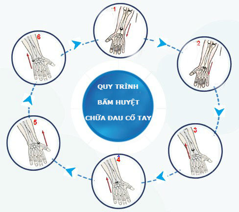 Các bước bấm huyệt chữa đau khớp cổ tay
