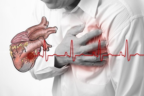 Thiếu máu cơ tim là căn bệnh dẫn đến nhiều biến chứng nguy hiểm