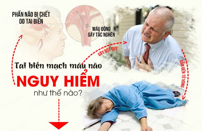 bệnh tai biến mạch máu não