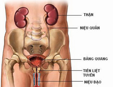 Vôi hóa tiền liệt tuyến