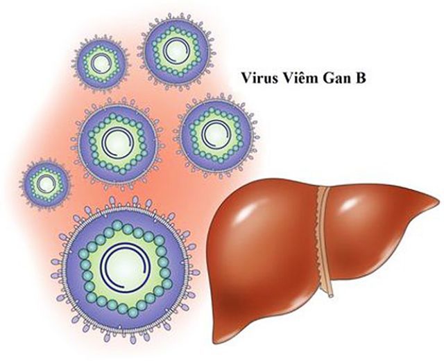Bệnh viêm gan b là một bệnh truyền nhiễm