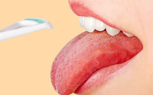 Lưỡi là một trong những bộ phận rất quan trọng của chúng ta