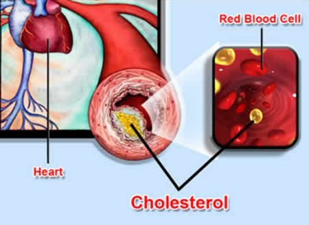 cholesterol cao