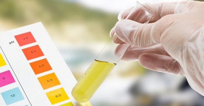 xét nghệm nước tiểu