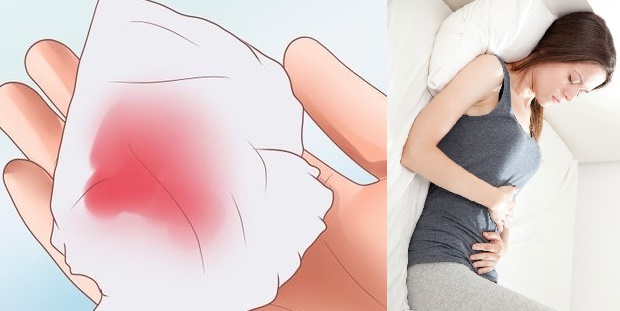 rối loạn kinh nguyệt ra máu đen là gì?