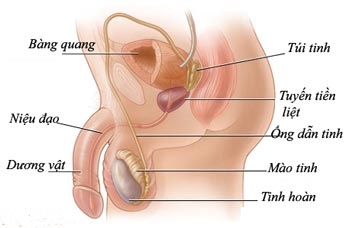 Khó tiểu có thể dẫn đến viêm tuyến tiền liệt